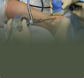 Артроскопия голеностопного сустава и суставов стопы