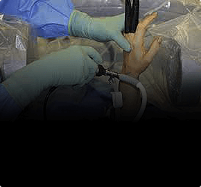 Артроскопия лучезапястного сустава и суставов кисти