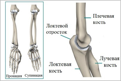 Перелом средней трети костей предплечья