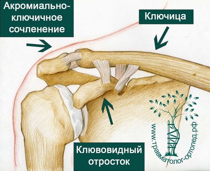 Лечение ключично акромиального артроза. Акромиально-ключичное сочленение плечевого сустава. Акромиально-ключичное сочленение плечевого сустава анатомия. Плечевой сустав акс анатомия. Связки акромиально-ключичного сустава.