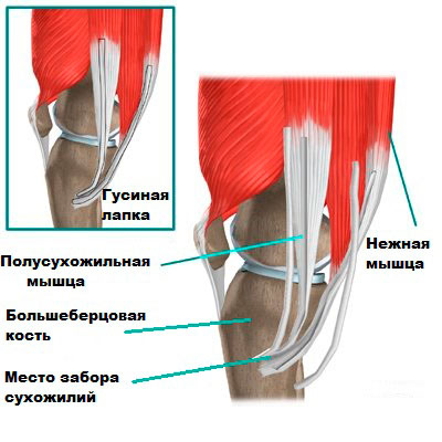Передние связки коленного сустава
