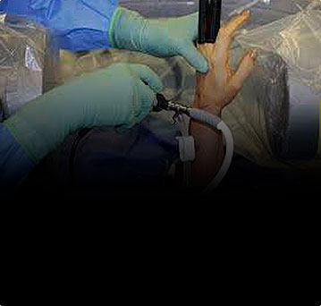 Что такое кистевая хирургия и артроскопия