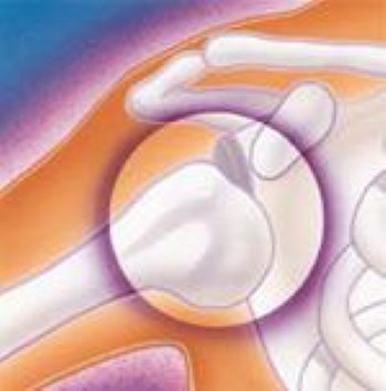 Травматология лечение плечевого сустава thumbnail