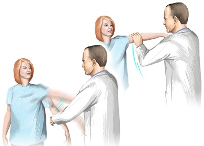 Растяжение манжеты плечевого сустава лечение