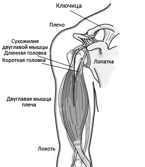 Ушиб двуглавой мышцы плеча