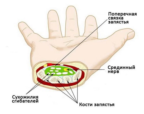 Эндоскопической операции синдром карпального канала thumbnail