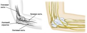 Перелом локтевой кости фото