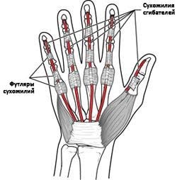 Переломы пальца кисти сухожилия