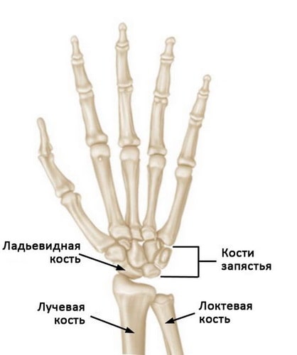 Перелом ладьевидной кости кисти рентген