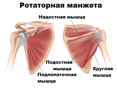 Повреждение надостной мышцы плеча