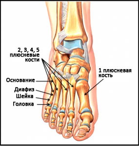 Перелом основания 4 плюсневой кости правой стопы