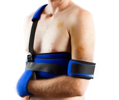 Импиджмент синдром плечевого сустава реабилитация